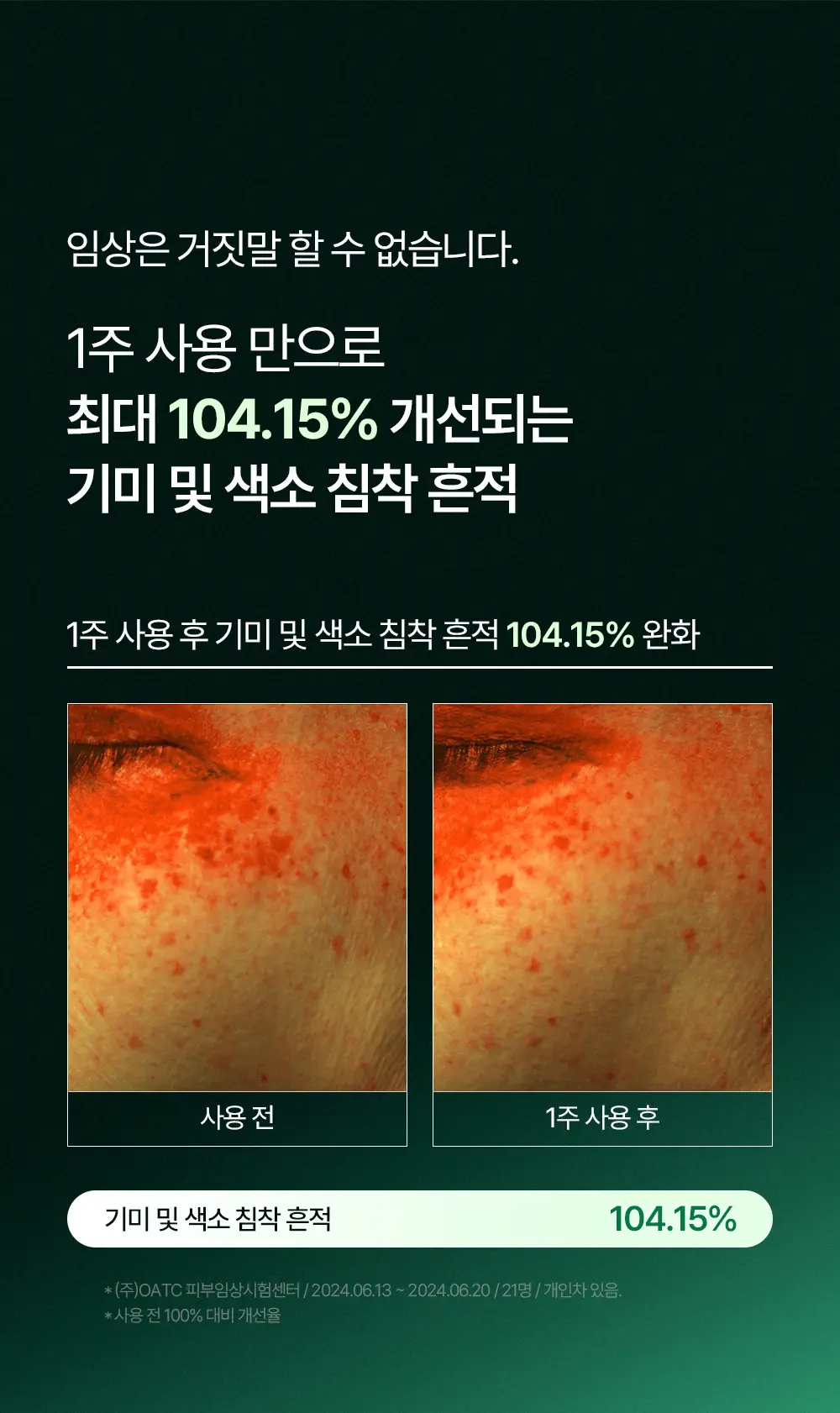 [티벳동생 공동개발] 오아조 피디알엔 쓰리디 부스팅 앰플 30ml 상세페이지 3